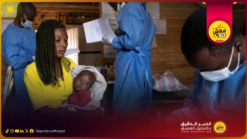 منظمة الصحة العالمية ترسل خبراء إلى الكونغو للتحقيق في مرض غامض