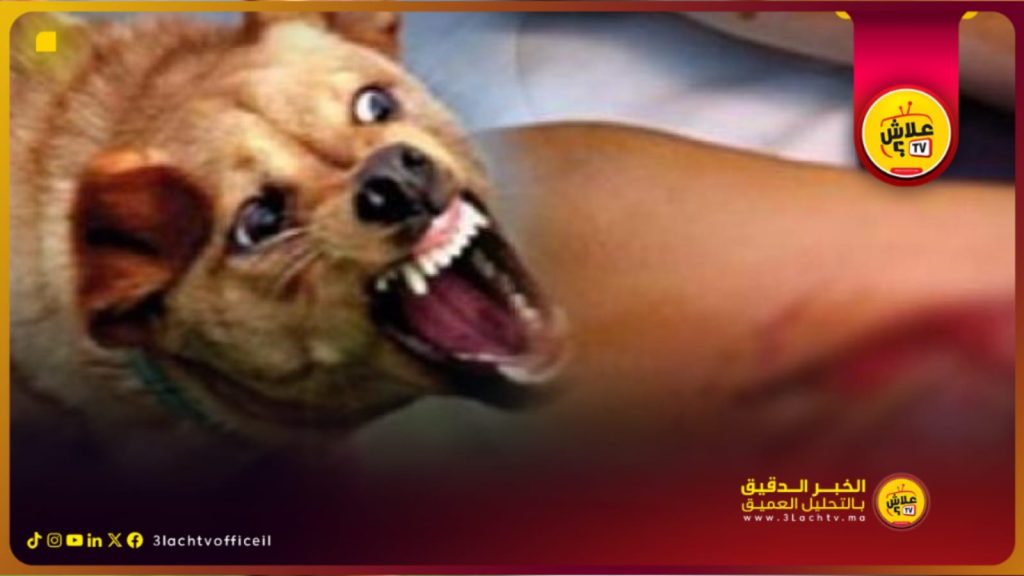 عضة كلب مسعور تكشف عن نقص خطير في مصل داء الكلب بمستشفى العرائش.